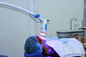 Tẩy trắng răng bằng công nghệ Laser có tốt không?